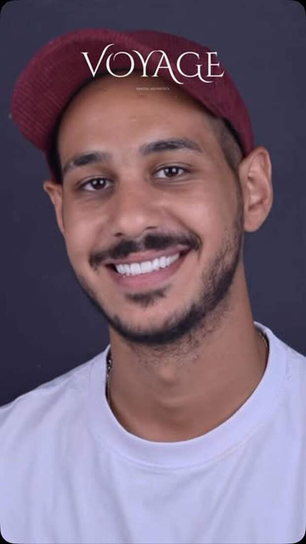 Patient smiling after completing treatment at Voyage Dental Aesthetics